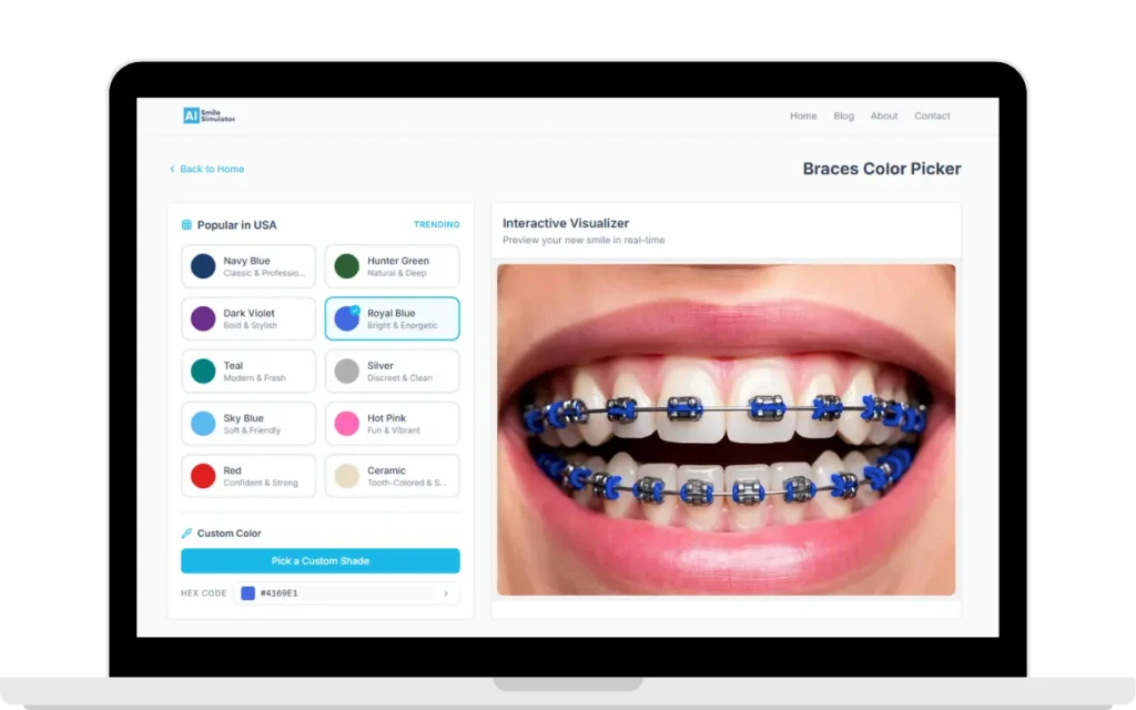 braces color simulation